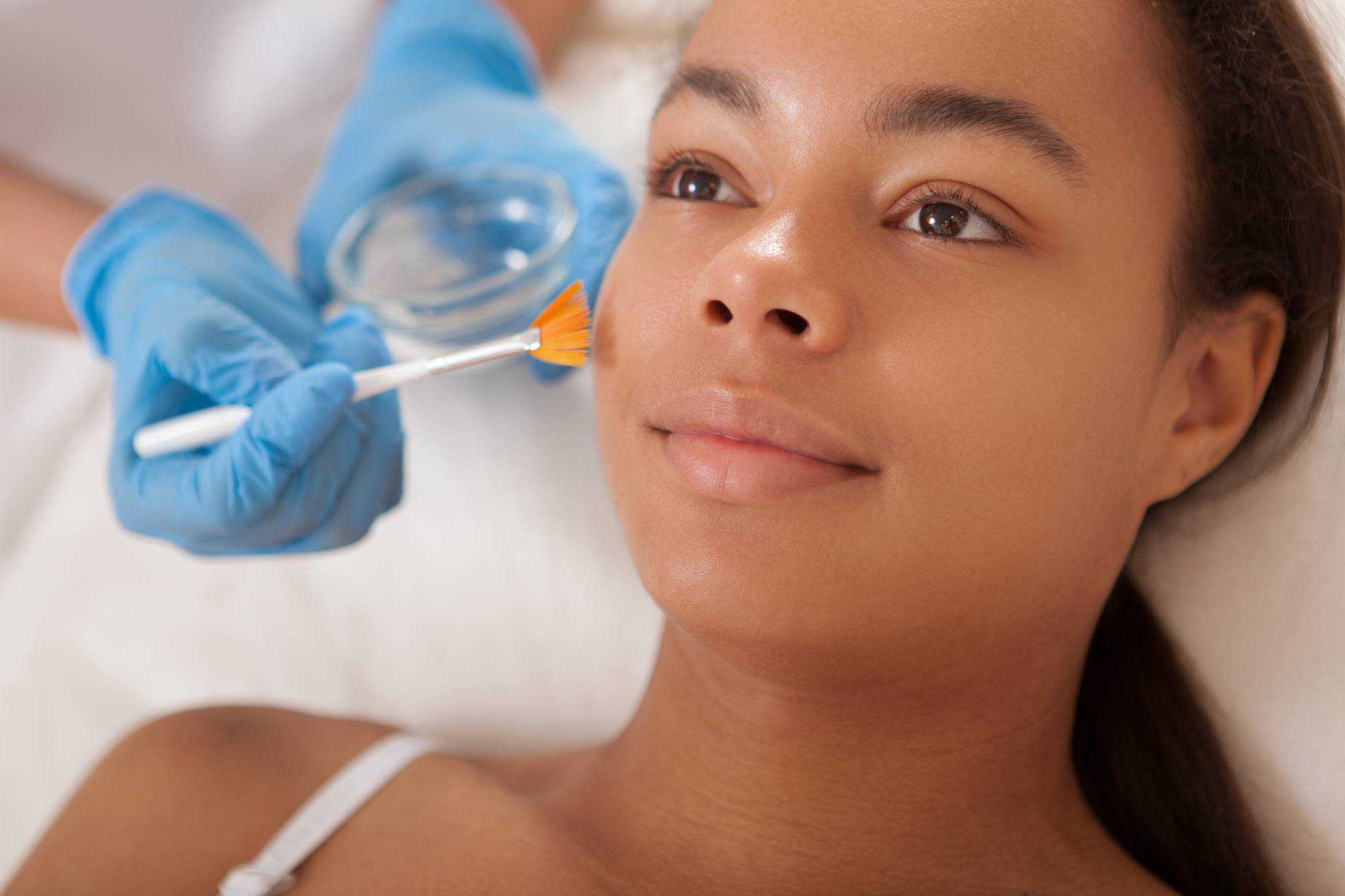 Vi Chemical Peel Service In Ocoee Fl By Renu Aesthetics And Wellness 0148